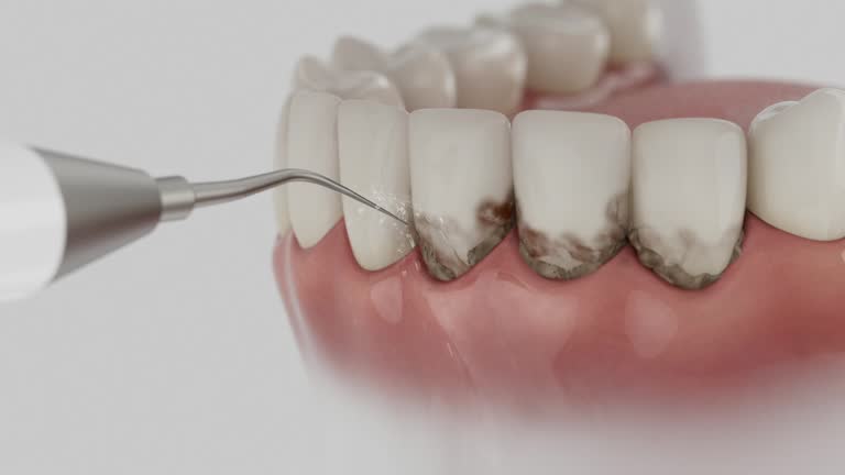 Trusted Teeth Cleaning And Checkup service in River Rouge, MI - Dentist Open Now